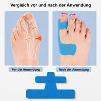 Ballentape™ Vorgeschnittenes Hallux-Entlastungsband (20 Stück)