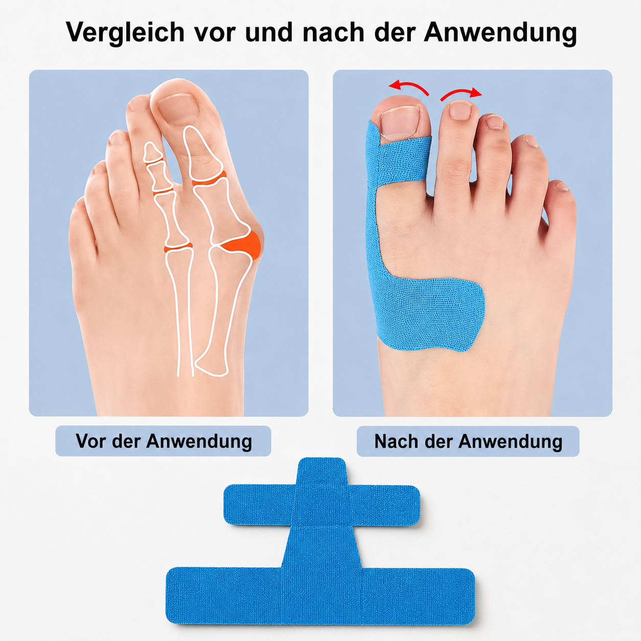 Ballentape™ Vorgeschnittenes Hallux-Entlastungsband (20 Stück)